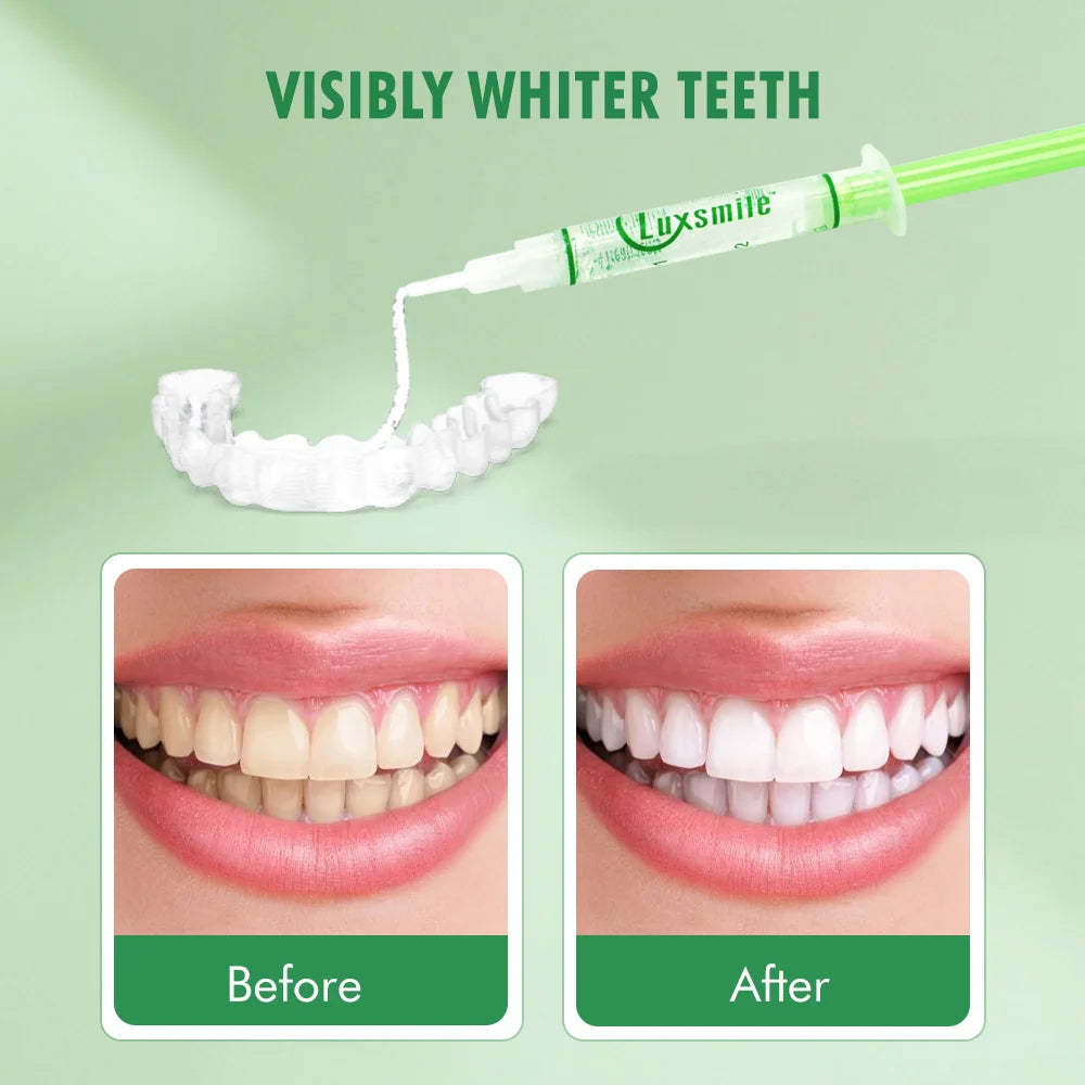 Luxsmile teeth protection